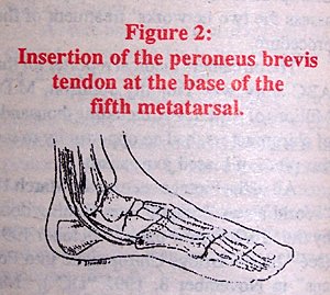 Insertion of the peroneus brevis tendon at the base of the fifth metatarsal. - Copyright – Stock Photo / Register Mark
