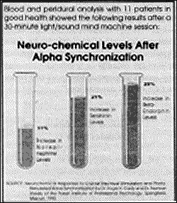 Neuro-chemical levels after alpha synchronization - Copyright – Stock Photo / Register Mark