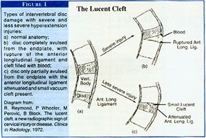 The Lucent Cleft - Copyright – Stock Photo / Register Mark