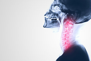 neck x-ray - Copyright – Stock Photo / Register Mark