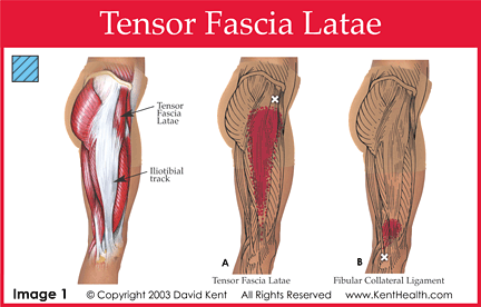 Tensor Fascia Latae