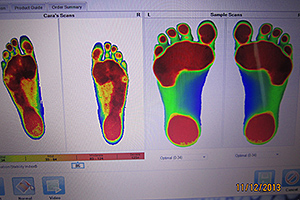 Digital Foot Scan - Copyright – Stock Photo / Register Mark
