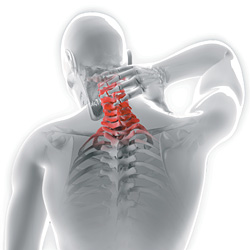 Neck pain - Copyright – Stock Photo / Register Mark