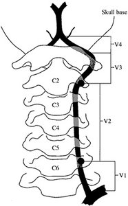 vertebral artery - Copyright – Stock Photo / Register Mark