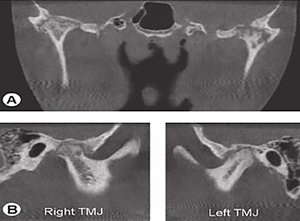 Cone beam CT of the TMJ - Copyright – Stock Photo / Register Mark