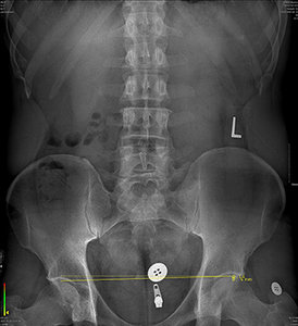 Standing X-ray - Copyright – Stock Photo / Register Mark