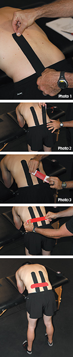 elastic therapeutic taping - Copyright – Stock Photo / Register Mark